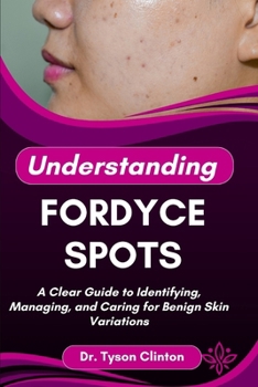 Paperback Understanding Fordyce Spots: A Clear Guide to Identifying, Managing, and Caring for Benign Skin Variations Book