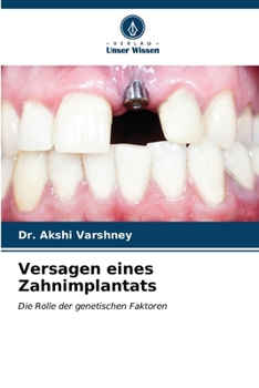 Versagen eines Zahnimplantats (German Edition)