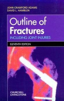 Paperback Outline of Fractures: Including Joint Injuries Book