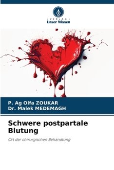 Paperback Schwere postpartale Blutung [German] Book