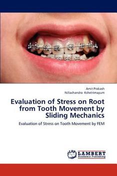 Paperback Evaluation of Stress on Root from Tooth Movement by Sliding Mechanics Book