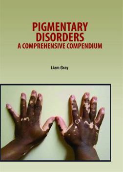 Hardcover Pigmentary Disorders A Comprehensive Compendium (Hb 2021) Book