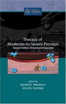 Therapy of Moderate-To Severe Psoriasis, Second Edition, Revised and Expanded