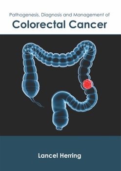 Hardcover Pathogenesis, Diagnosis and Management of Colorectal Cancer Book