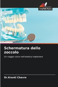 Schermatura dello zoccolo (Italian Edition)