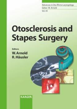 Hardcover Otosclerosis And Stapes Surgery (Advances in Oto-Rhino-Laryngology) Book