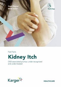 Paperback Fast Facts: Kidney Itch Book
