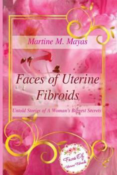 Paperback Faces of Uterine Fibroids: Untold Stories of A Woman's Biggest Secrets Book