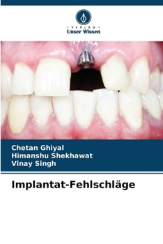 Paperback Implantat-Fehlschläge [German] Book