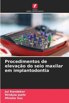 Procedimentos de elevação do seio maxilar em implantodontia (Portuguese Edition)
