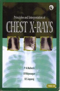 Paperback Principles and Interpretation of Chest X-Rays [With CDROM] Book