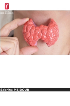 Paperback Determinação da tiroglobulina e dos anticorpos anti-tiroglobulina [Portuguese] Book