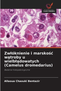 Zwlóknienie i marskosc watroby u wielbladowatych (Camelus dromedarius) (Polish Edition)