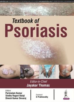 Paperback Textbook of Psoriasis Book