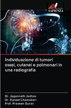 Paperback Individuazione di tumori ossei, cutanei e polmonari in una radiografia [Italian] Book