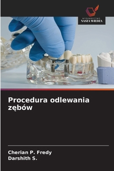 Procedura odlewania zebów (Polish Edition)