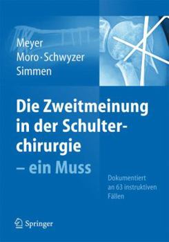 Hardcover Die Zweitmeinung in Der Schulterchirurgie - Ein Muss [German] Book