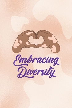 Embrace Diversity: Notebook Journal Composition Blank Lined Diary Notepad 120 Pages Paperback Nude Texture Vitiligo