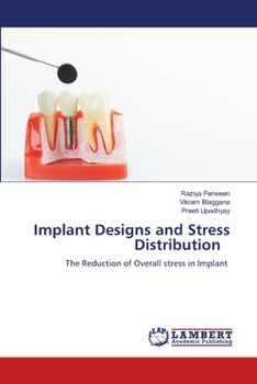 Paperback Implant Designs and Stress Distribution Book