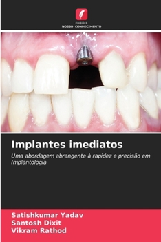 Paperback Implantes imediatos [Portuguese] Book