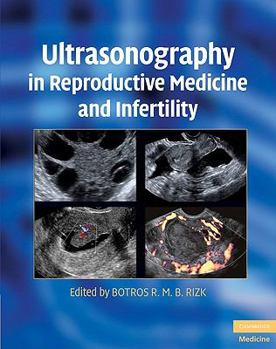 Hardcover Ultrasonography in Reproductive Medicine and Infertility Book