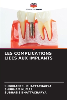 Paperback Les Complications Liées Aux Implants [French] Book