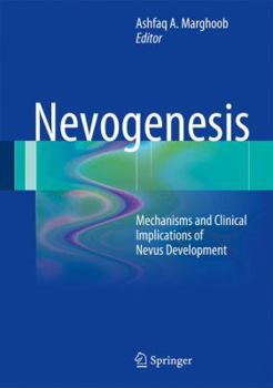 Hardcover Nevogenesis: Mechanisms and Clinical Implications of Nevus Development Book