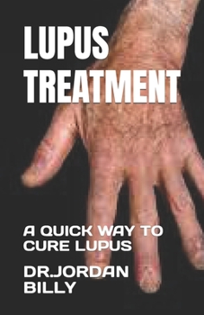 Paperback Lupus Treatment: A Quick Way to Cure Lupus Book