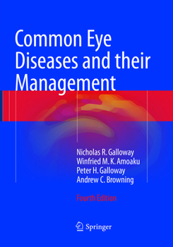 Paperback Common Eye Diseases and Their Management Book