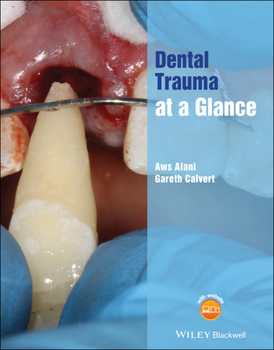 Paperback Dental Trauma at a Glance Book