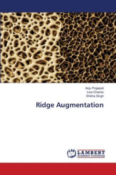 Paperback Ridge Augmentation Book