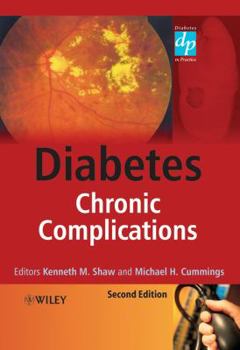 Paperback Diabetes: Chronic Complications Book