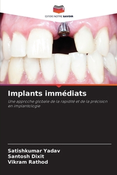 Paperback Implants immédiats [French] Book