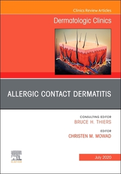 Hardcover Allergic Contact Dermatitis, an Issue of Dermatologic Clinics: Volume 38-3 Book
