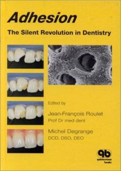 Hardcover Adhesion: The Silent Revolution in Dentistry Book