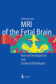 Paperback MRI of the Fetal Brain: Normal Development and Cerebral Pathologies Book