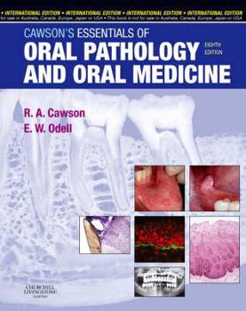 Paperback Cawson's Essentials of Oral Pathology and Oral Medicine Book