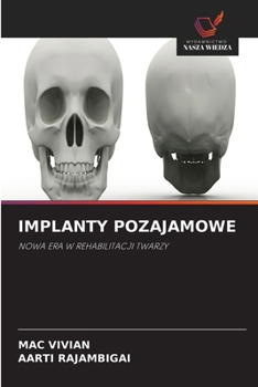 Implanty Pozajamowe (Polish Edition)
