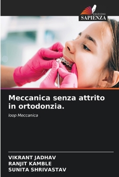 Meccanica senza attrito in ortodonzia.: loop Meccanica