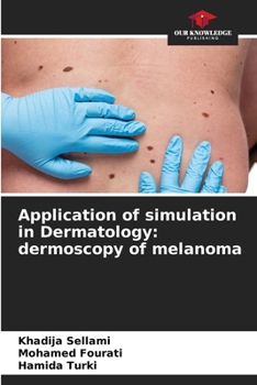 Paperback Application of simulation in Dermatology: dermoscopy of melanoma Book