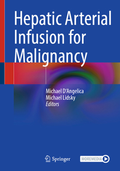 Hepatic Artery Infusion for Malignancy