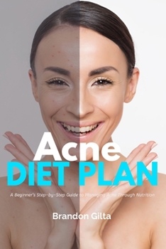 Paperback Acne Diet Plan: A Beginner's Step-by-Step Guide to Managing Acne Through Nutrition With Curated Recipes and a Sample Meal Plan Book