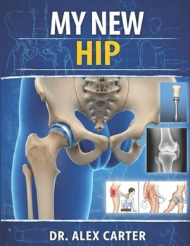 Paperback My New Hip: The Complete Guide to Hip Replacement Surgery, Recovery, Rehab, Pain Relief, Exercises, and Regaining Mobility Book