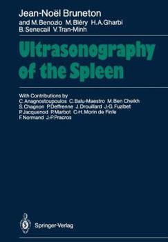 Paperback Ultrasonography of the Spleen Book