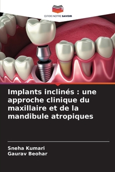 Implants inclinés: une approche clinique du maxillaire et de la mandibule atropiques (French Edition)