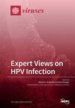 Paperback Expert Views on HPV Infection Book