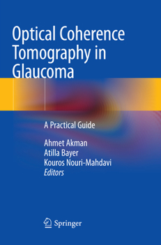 Paperback Optical Coherence Tomography in Glaucoma: A Practical Guide Book