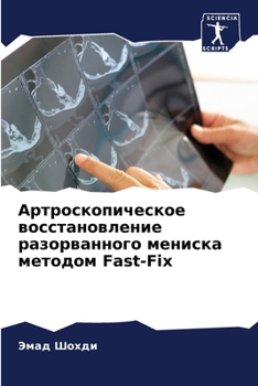 Paperback Артроскопическое восст&# [Russian] Book