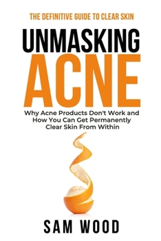 Paperback Unmasking Acne: The Definitive Guide to Clear Skin: Why Acne Products Don't Work and How You Can Get Permanently Clear Skin from Withi Book
