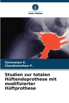 Paperback Studien zur totalen Hüftendoprothese mit modifizierter Hüftprothese [German] Book